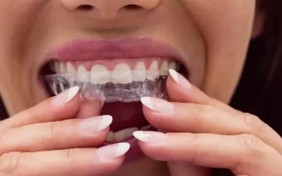 Invisalign Oakland: Clear Aligner Therapy for Discreet Orthodontic Correction